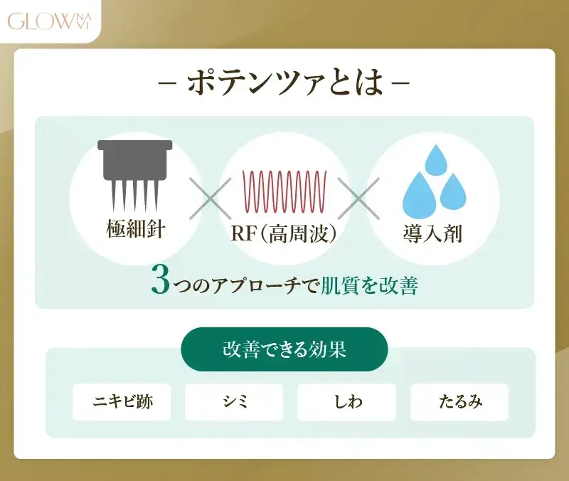 ポテンツァとは