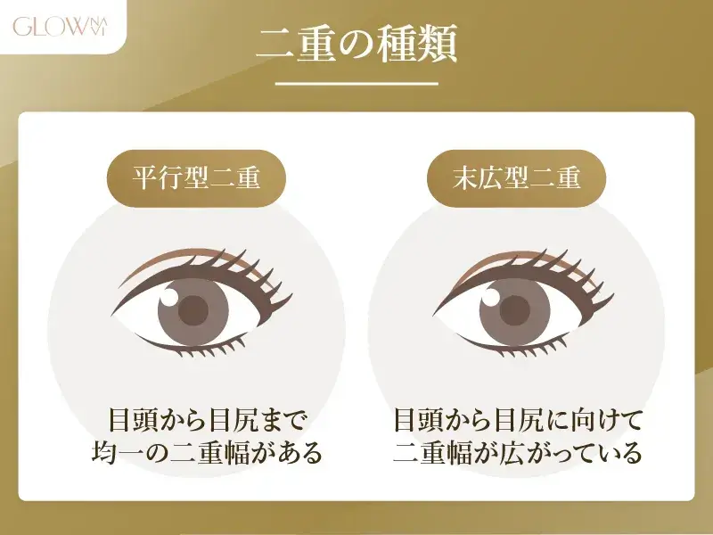 二重整形の種類