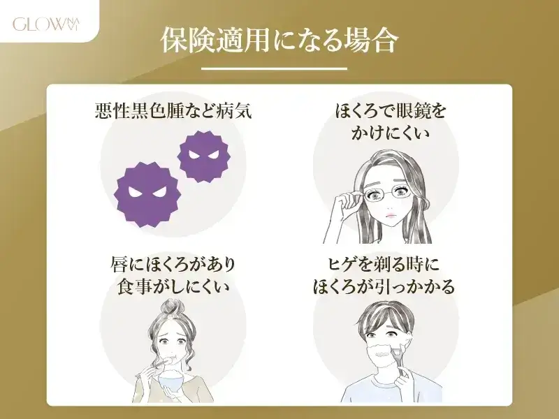 ほくろ除去が保険適用になる場合