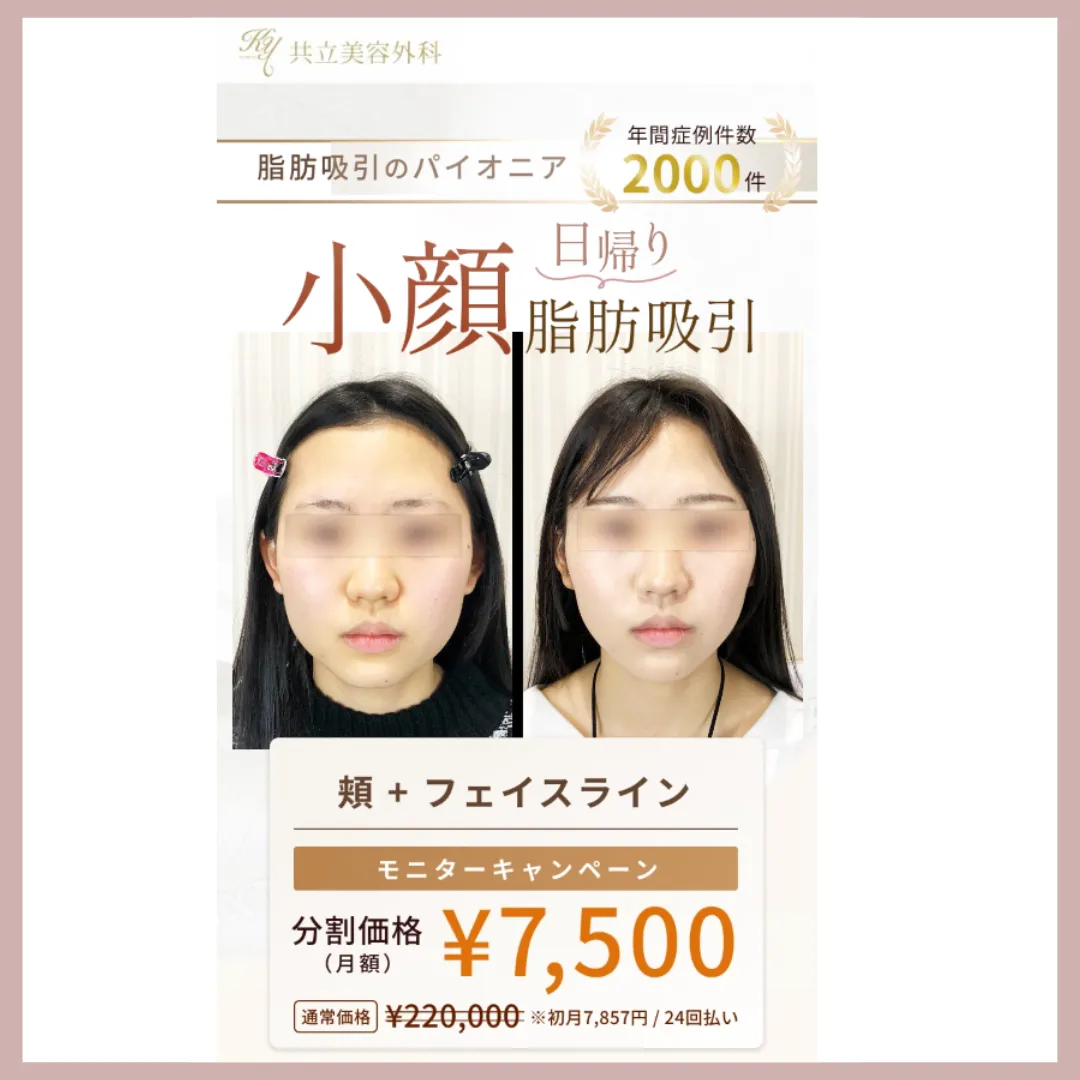 共立美容外科　脂肪吸引