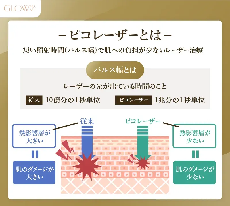 ピコレーザーの仕組み解説