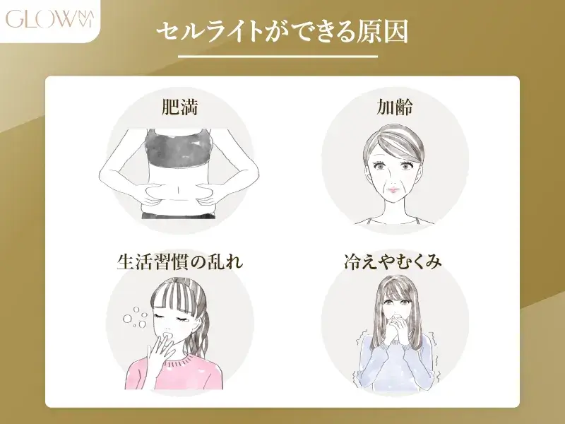 セルライトができる原因