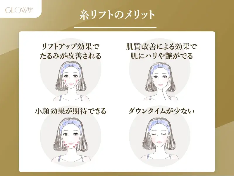 糸リフトのメリット