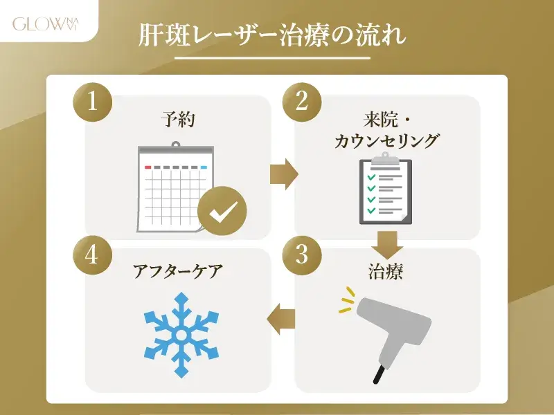 肝斑治療の流れ