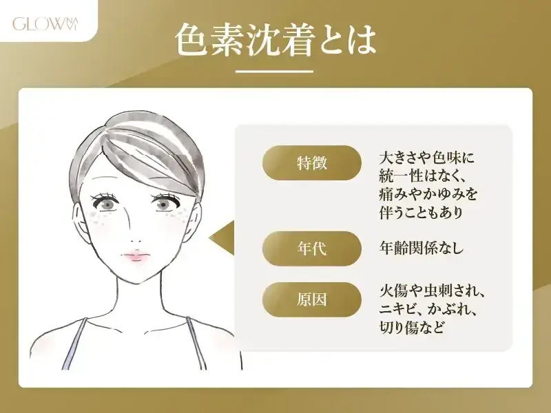 色素沈着とは