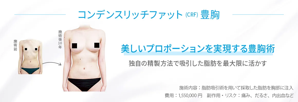 美容外科シンシア豊胸LP