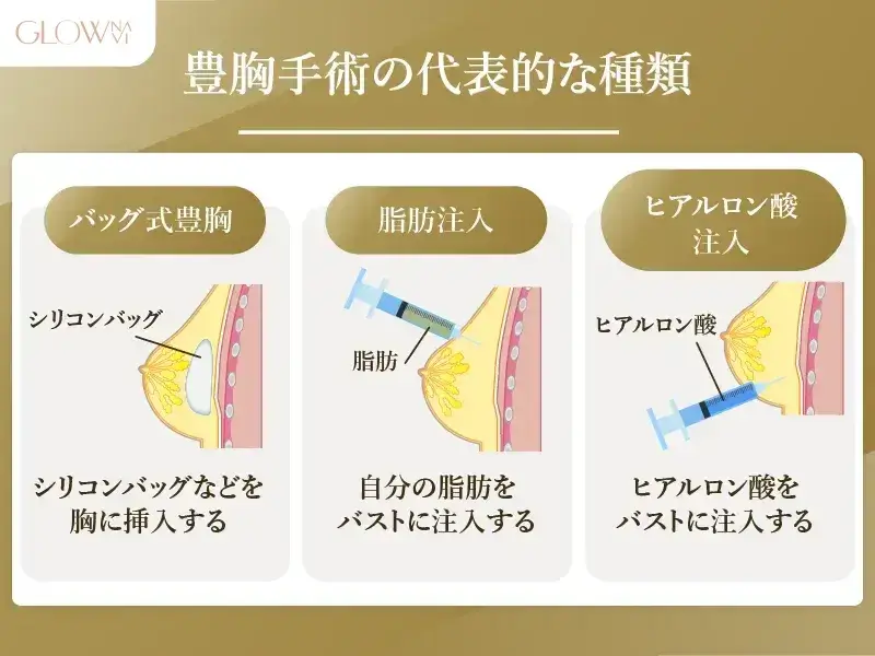 豊胸手術の種類