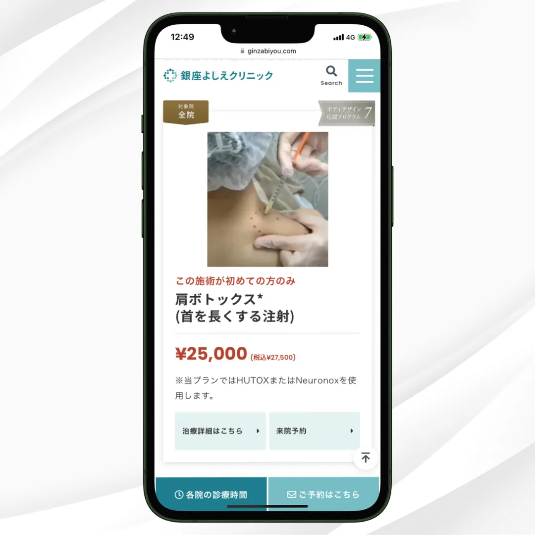銀座よしえクリニック 肩ボトックス
