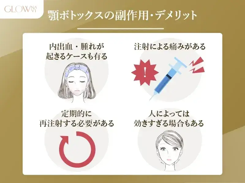顎ボトックスの副作用・デメリット